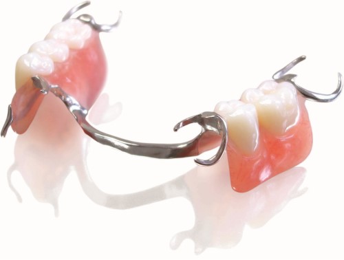 răng giả tháo lắp bán phần