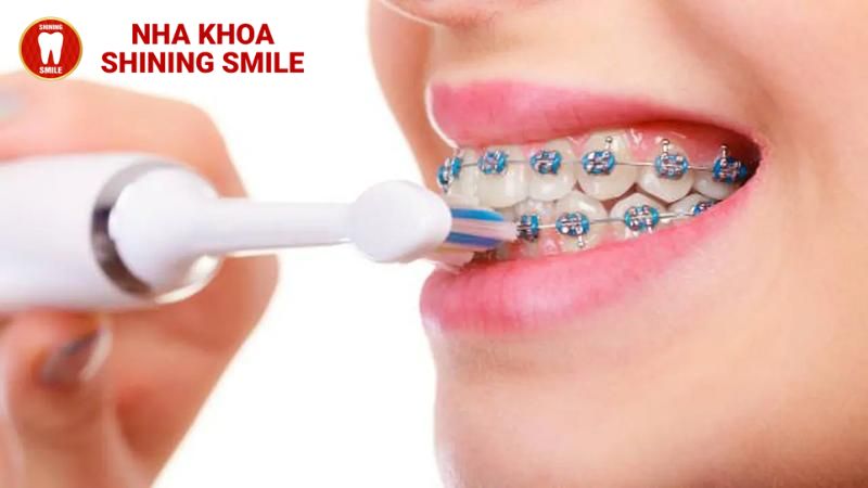 Bắc Cầu Răng Sứ - Giải Pháp Nhanh Chóng Cho Nụ Cười Hoàn Hảo