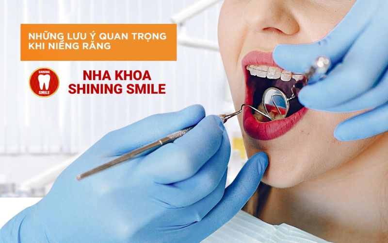 Lấy Dấu Răng Khi Niềng Để Làm Gì? Tìm Hiểu Ngay!