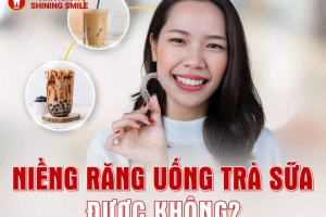 Niềng Răng Uống Trà Sữa Được Không? Thông Tin Cần Biết