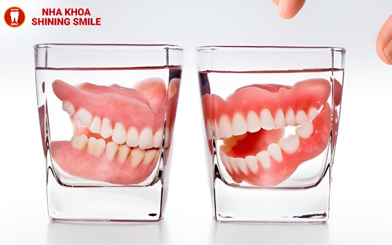 Hiểu Về Các Loại Khớp Cắn Trong Chỉnh Nha