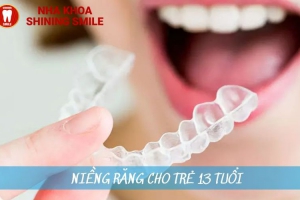Tìm Hiểu Về Niềng Răng Cho Trẻ 13 Tuổi: Những Điều Cần Biết
