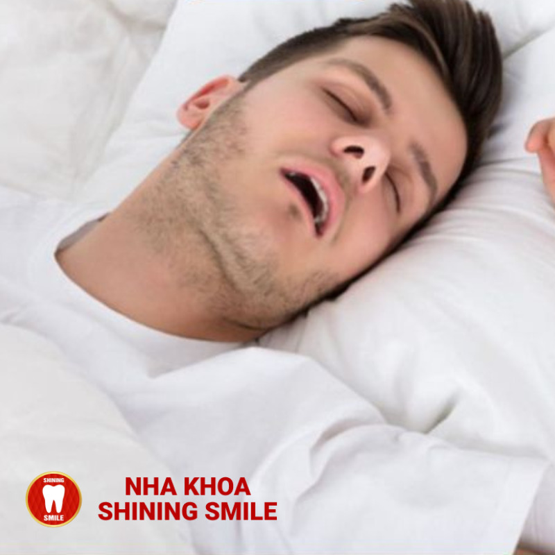 Nhổ 8 Răng Để Niềng: Khi Nào Cần Thiết Và Những Điều Cần Biết