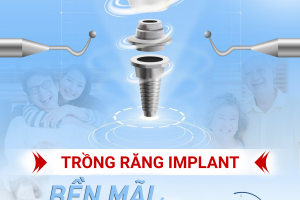 Mất răng lâu năm có trồng được không? Phương pháp nào tốt?