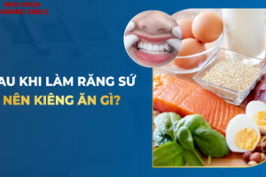 Những Điều Cần Kiêng Kị Sau Khi Mới Bọc Răng Sứ