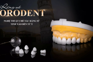 Răng Sứ OroDent Giá Bao Nhiêu? Thông Tin Chi Tiết