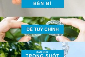 Chi Phí Niềng Răng Lệch Khớp Cắn Tại Shining Smile