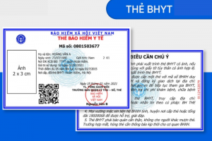 Trồng Răng Có Được Hưởng Bảo Hiểm Y Tế Không? Thông Tin Cực Kỳ Hữu Ích!