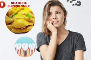 Trồng Răng Implant Có Ăn Được Thịt Gà Không? Chuyên Gia Tư Vấn!