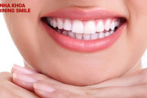 Có nên niềng răng ở người lớn hay không?