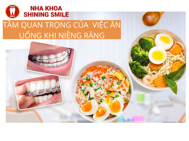 Quy Trình Bọc Răng Sứ: Chi Tiết Từng Bước Thực Hiện