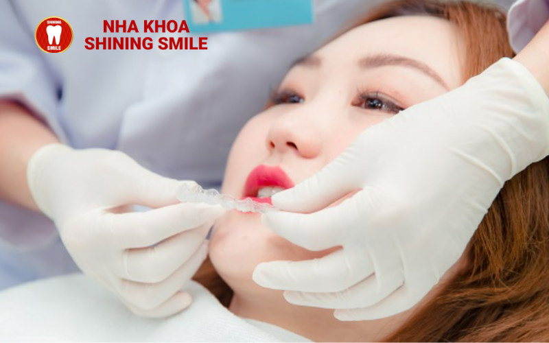 Niềng Răng Bị Đau Chân Răng: Nguyên Nhân và Giải Pháp Giảm Đau