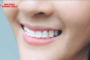 thiet-ke-chua-co-ten-48.png