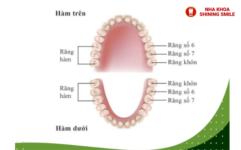 Niềng răng có giúp mặt hết lệch không?