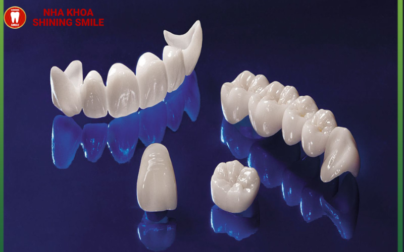 Răng sứ có niềng được không? Lưu ý quan trọng