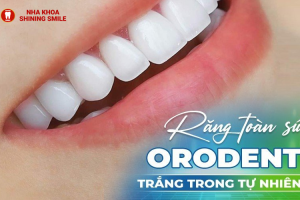 Răng Sứ OroDent Giá Bao Nhiêu? Tìm Hiểu Chi Tiết Ngay!