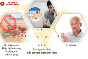 Các Phương Pháp Trồng Răng Hiện Đại: Đâu Là Lựa Chọn Hoàn Hảo Cho Bạn?